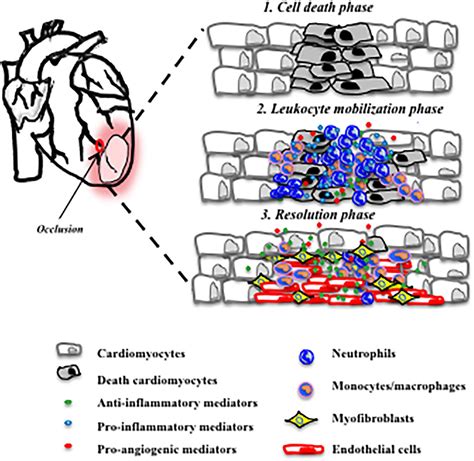 myocardial infarction recovery